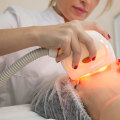 How Long Does UV Therapy Take to See Results?